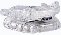 The TAP sleep apnea oral appliance